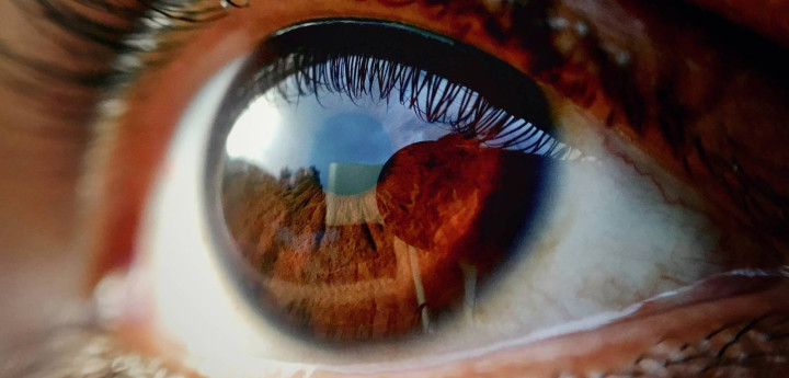 eye-image-1753713058.jpg